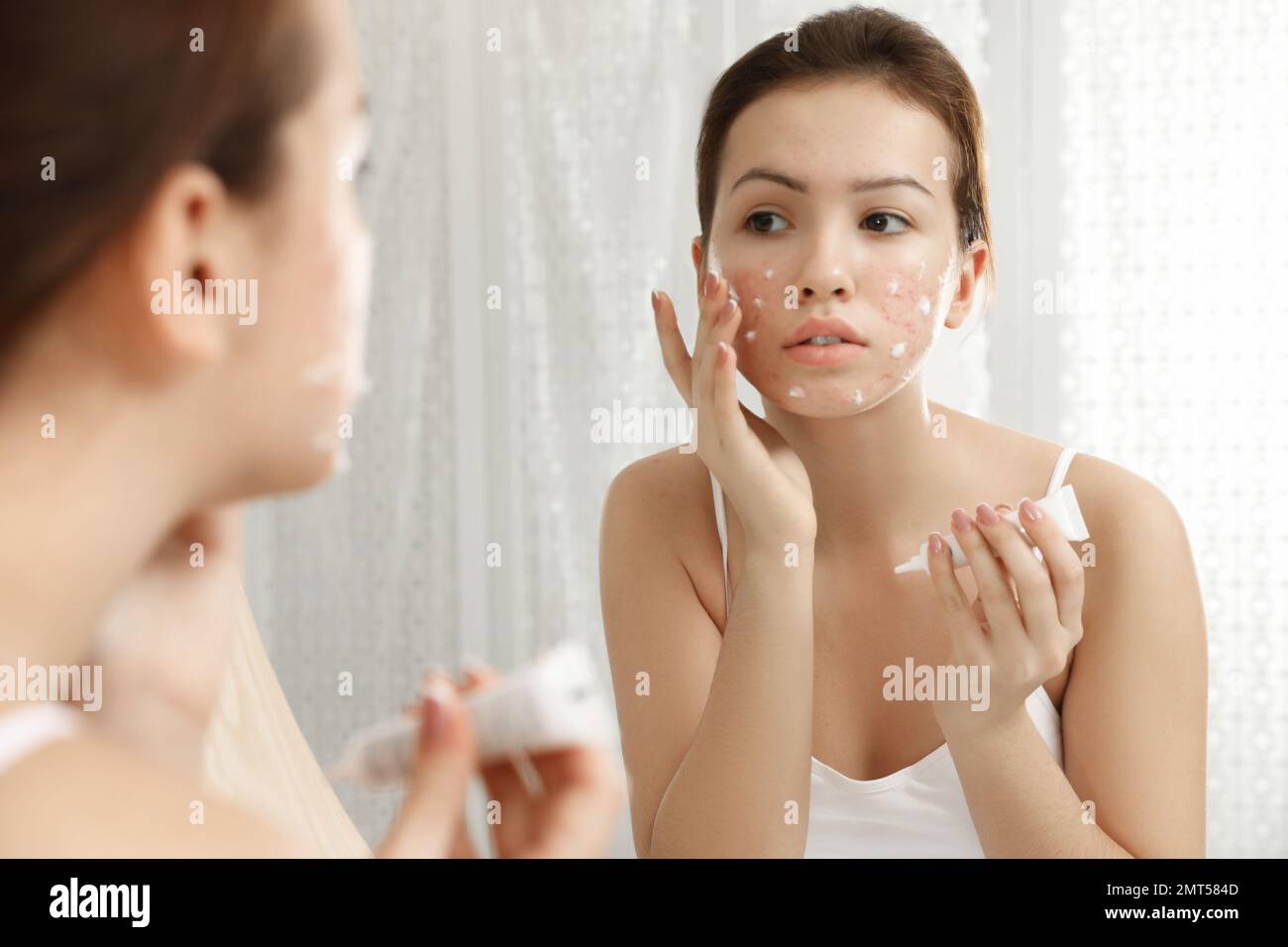 Acne: Tips for managing - American Academy of Dermatology - Suffering From Acne Problems
