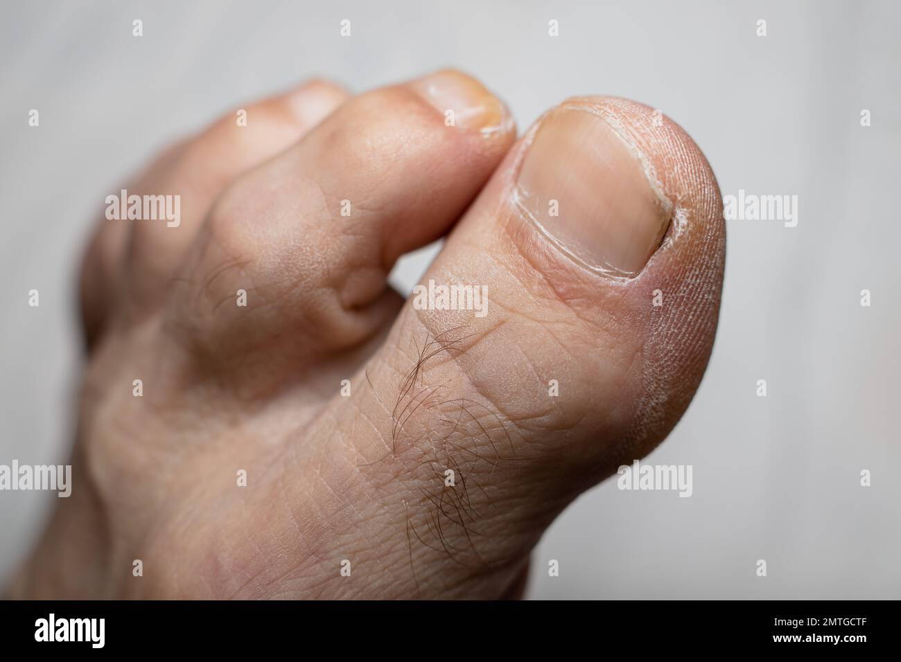 Older man feet fingers - dry skin - Shallow focus blur background Stock Photo