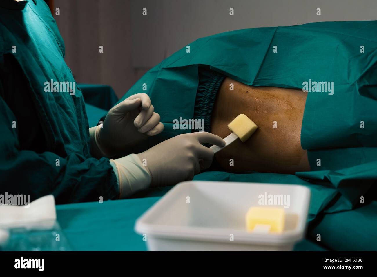 Doctor or surgeon apply betadine to the patient for anesthesia