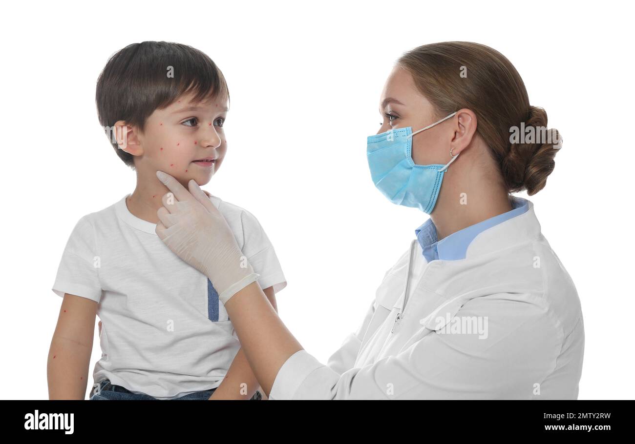Chickenpox Doctor Doctor examining little boy with chickenpox on white background ...