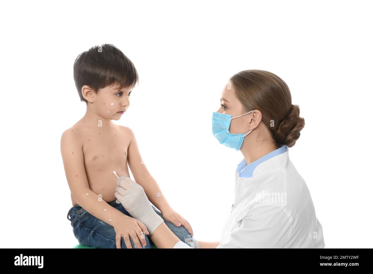 Chickenpox Doctor Doctor applying cream onto skin of little boy with chickenpox against ...