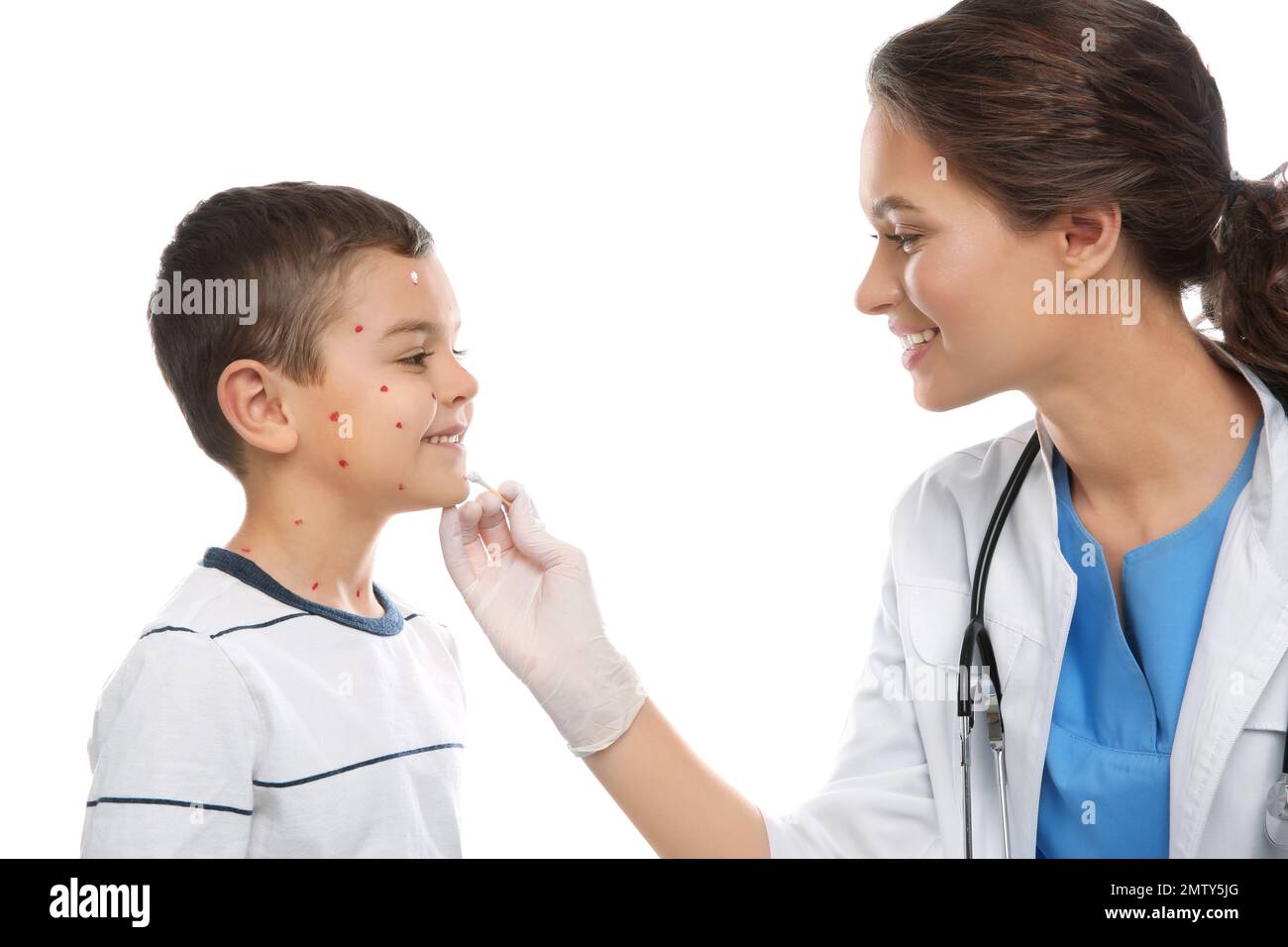 Chickenpox Doctor Doctor applying cream onto skin of little boy with chickenpox on white ...
