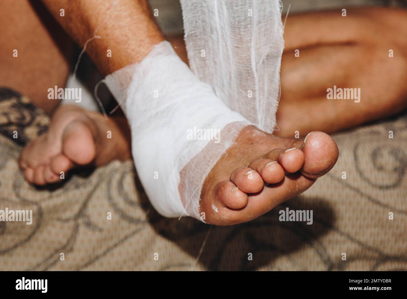 the process of selfbandaging the leg after surgery. Dressing injuries