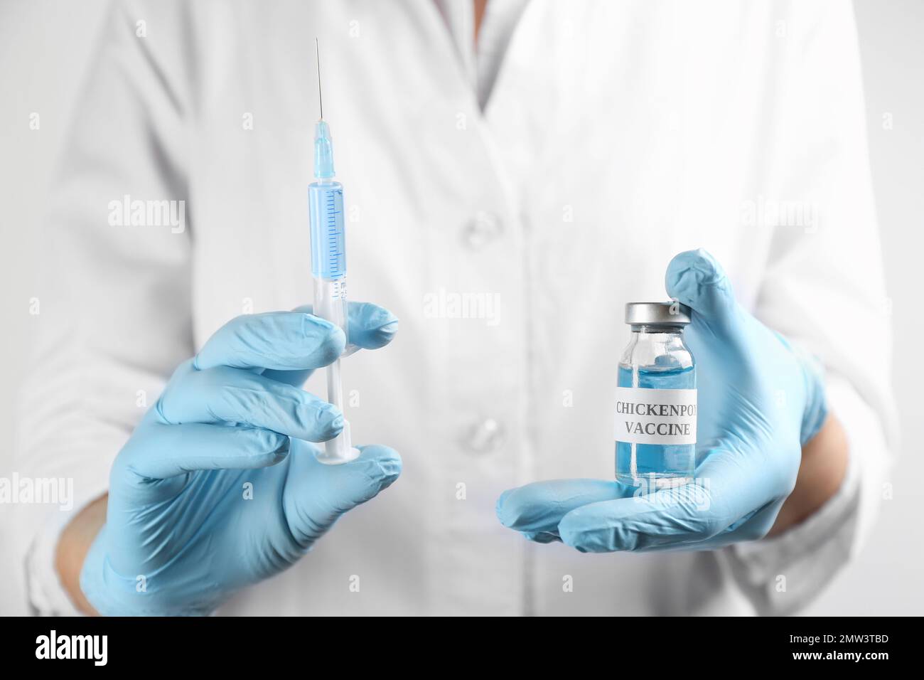 Chickenpox Doctor Doctor holding chickenpox vaccine and syringe, closeup. Varicella virus ...