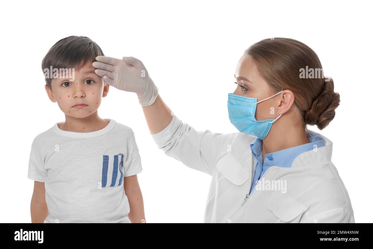 Chickenpox Doctor Doctor examining little boy with chickenpox on white background ...