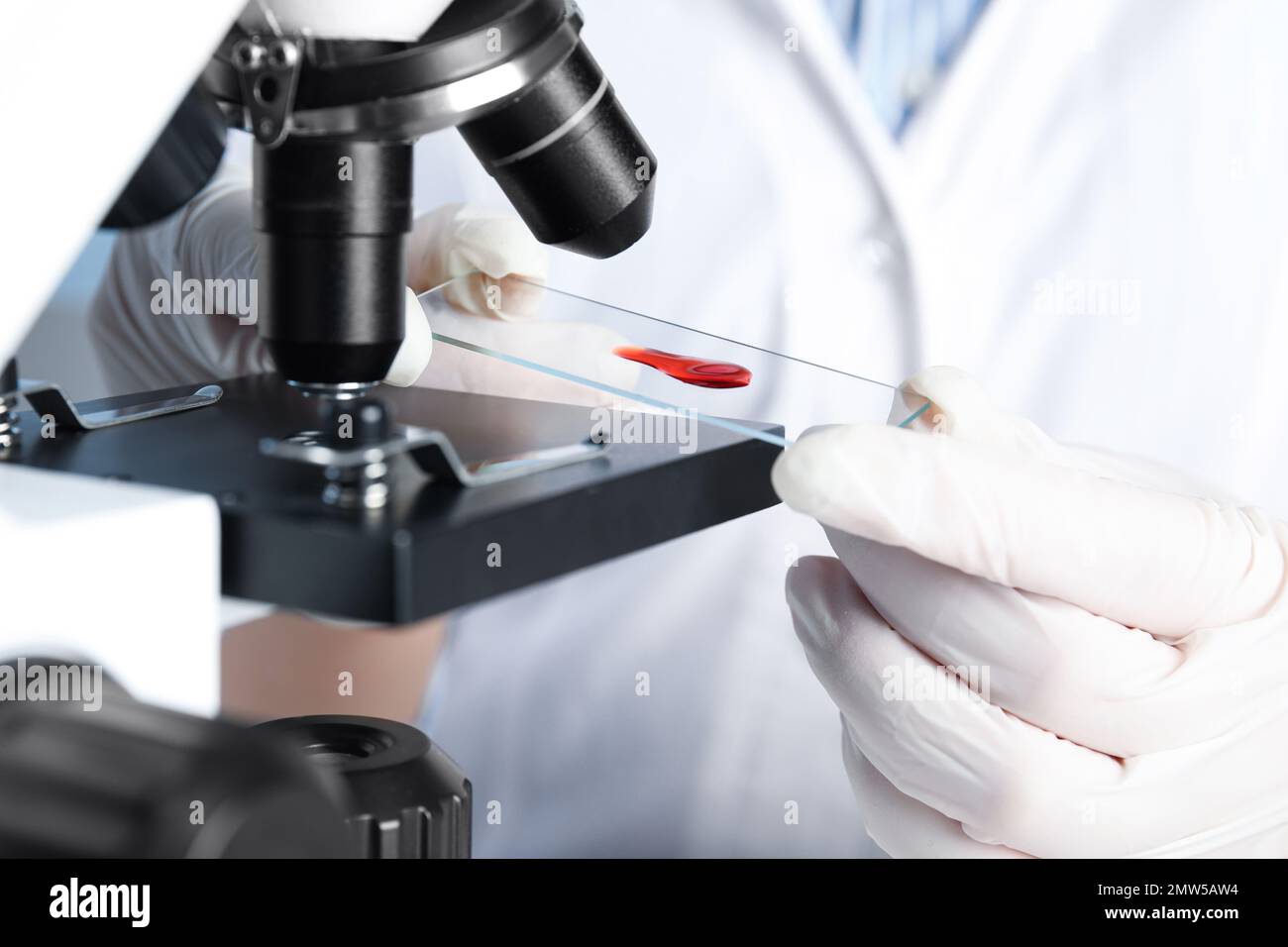 Scientist holding slide with blood sample near microscope in laboratory