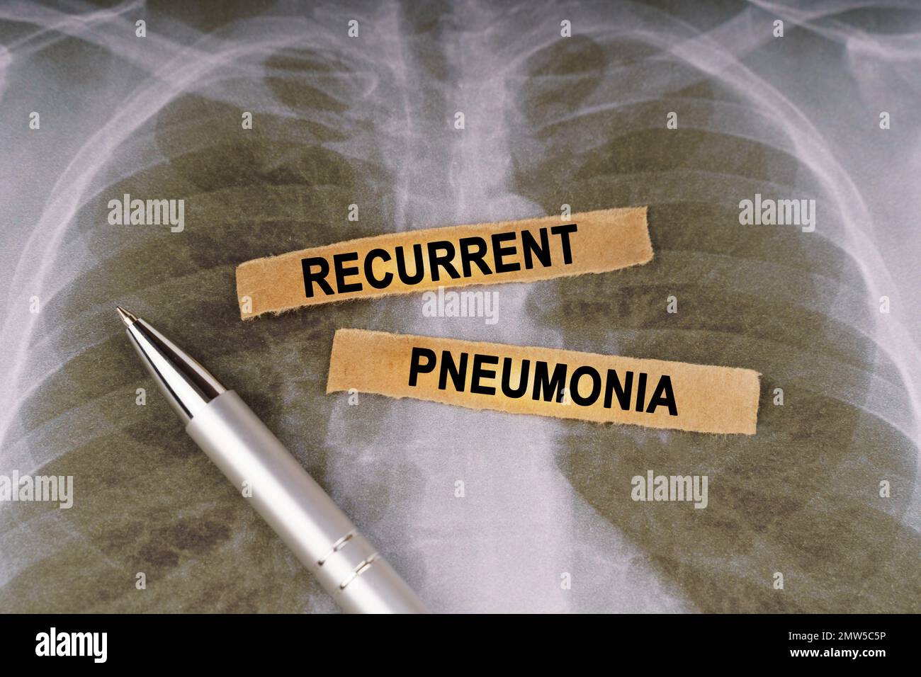 Medical concept. On a human chest xray, a pen and strips of paper