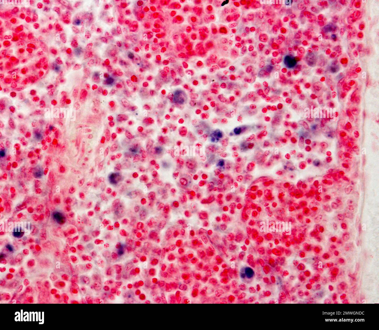 Lymph node macrophages, light micrograph Stock Photo - Alamy