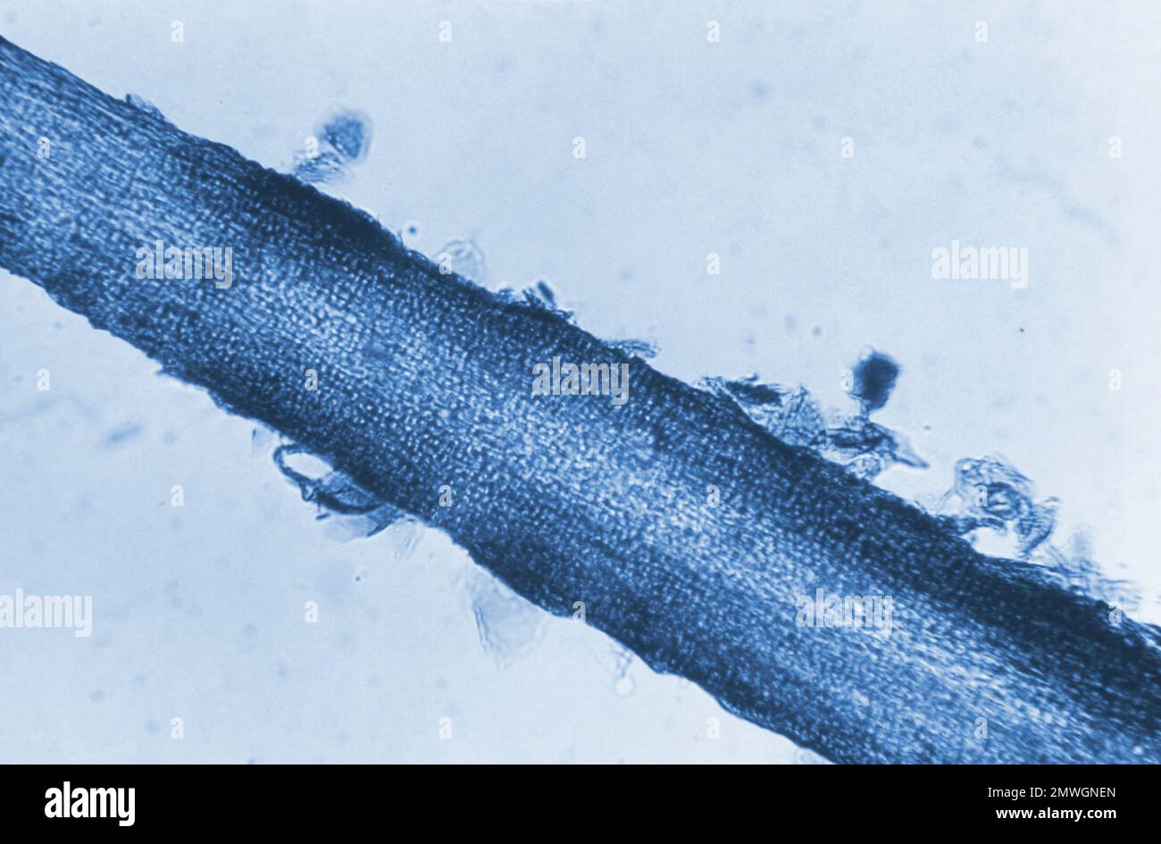 ringworm-infection-light-micrograph-stock-photo-alamy