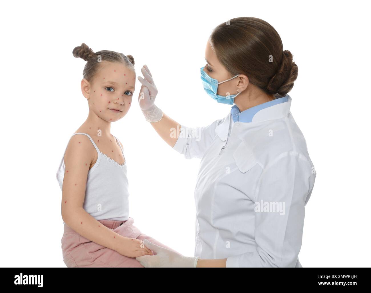 Chickenpox Doctor Doctor examining little girl with chickenpox on white background ...