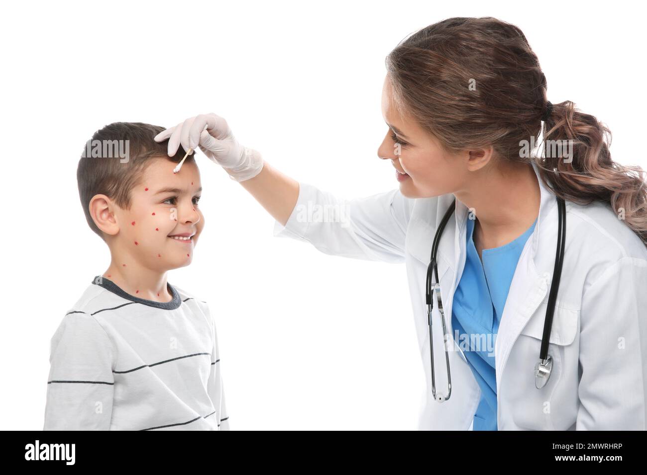 Chickenpox Doctor Doctor applying cream onto skin of little boy with chickenpox on white ...