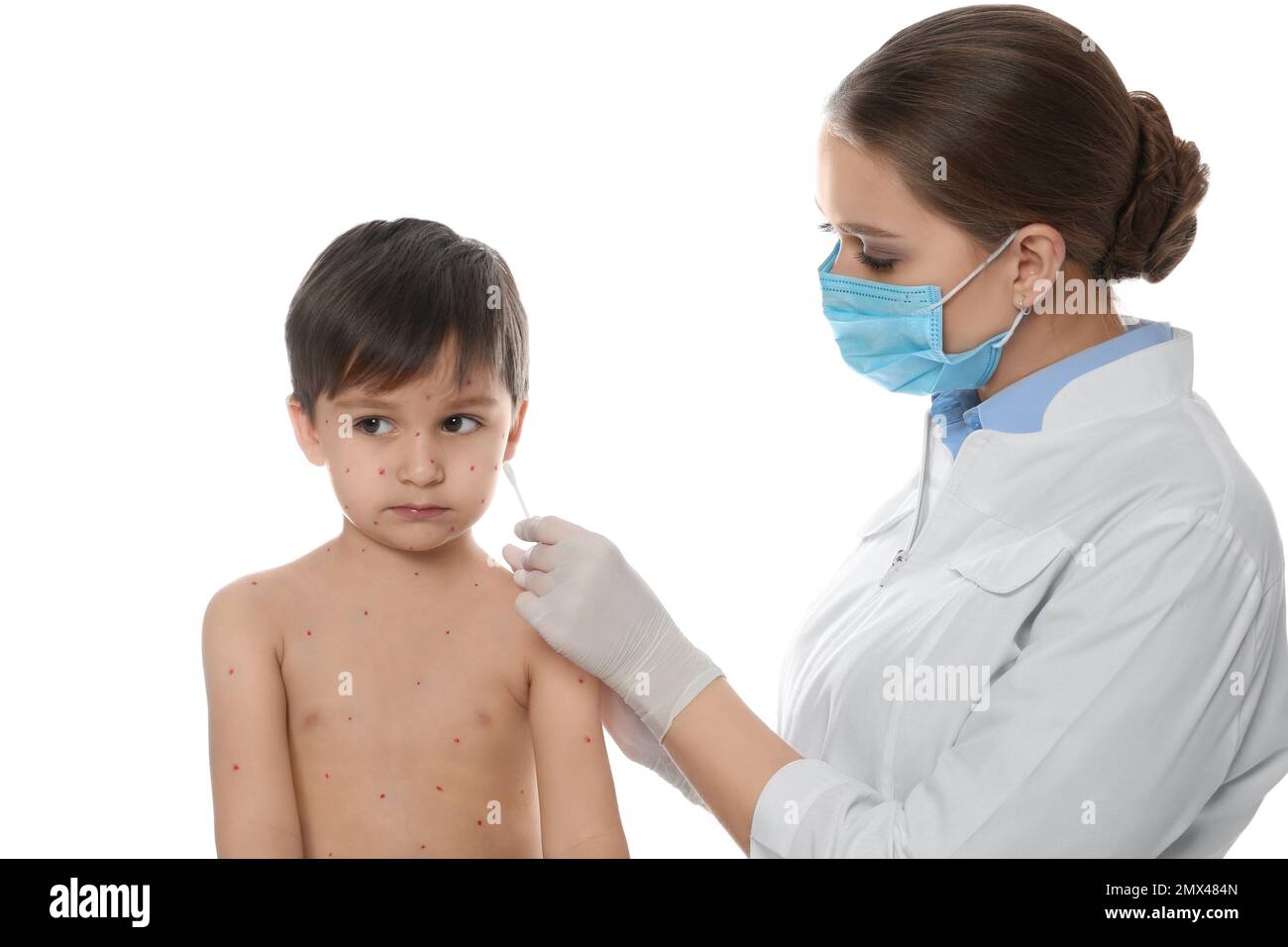 Chickenpox Doctor Doctor applying cream onto skin of little boy with chickenpox against ...