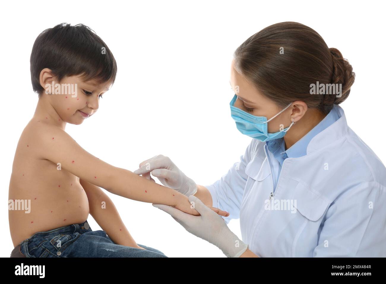 Chickenpox Doctor Doctor examining little boy with chickenpox on white background ...