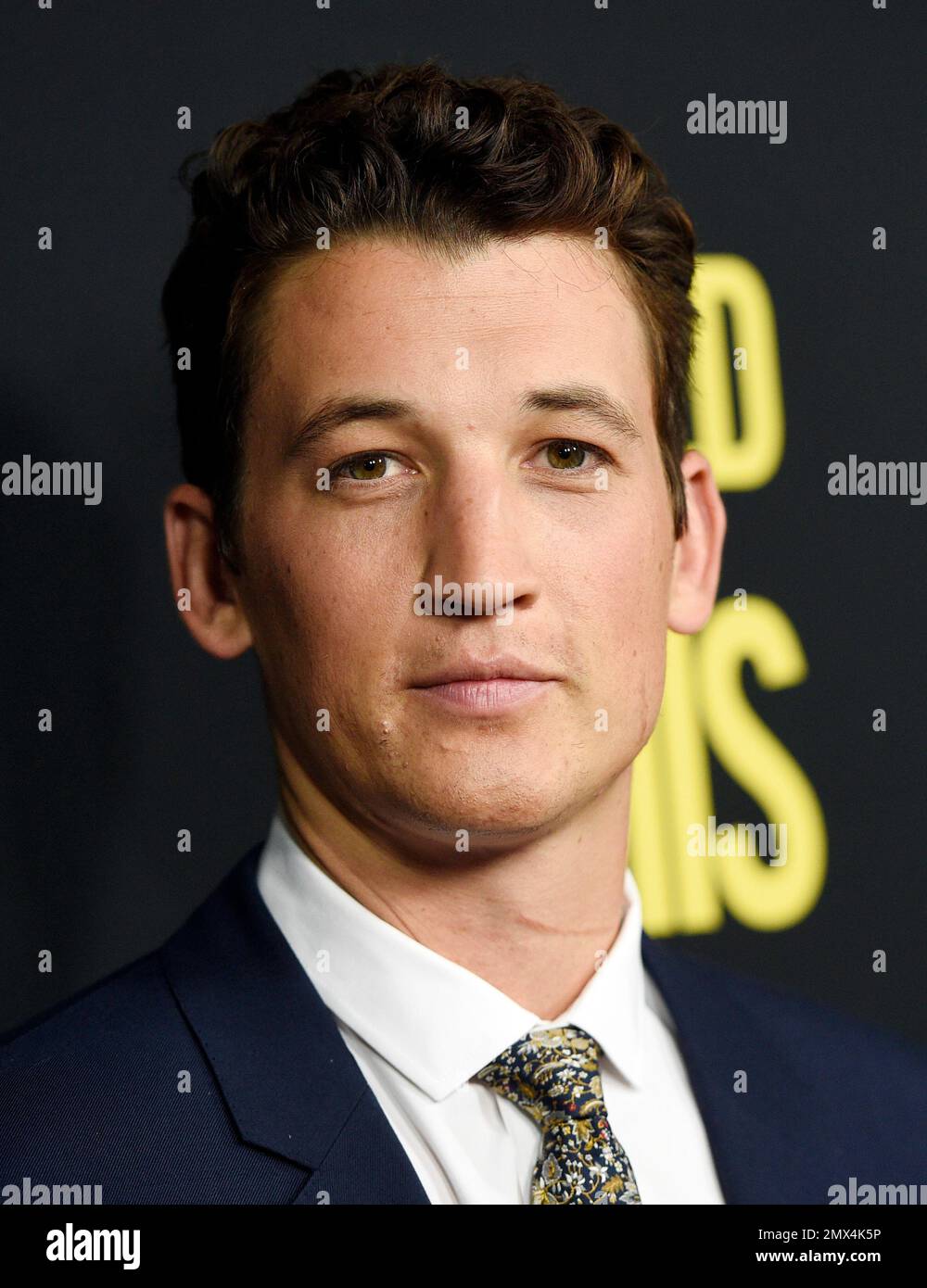 Miles Teller, who plays former boxer Vinny Pazienza in "Bleed for This