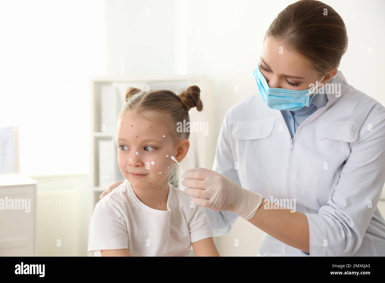 Chickenpox Doctor Doctor applying cream onto skin of little girl with chickenpox in ...