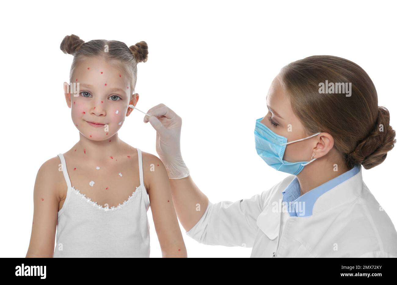 Chickenpox Doctor Doctor applying cream onto skin of little girl with chickenpox against ...