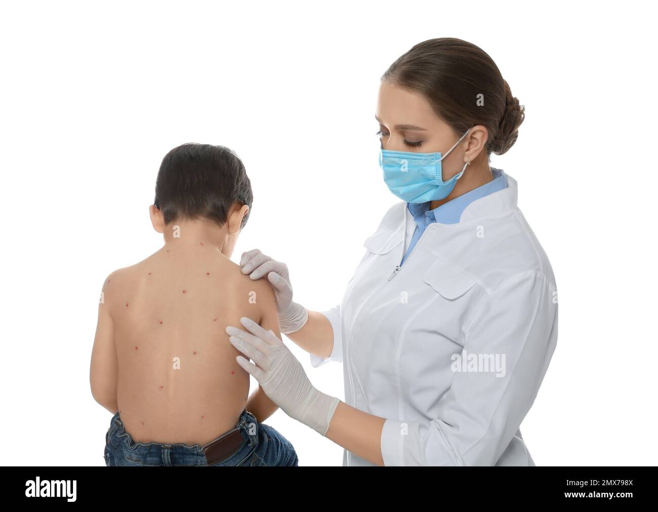 Chickenpox Doctor Doctor examining little boy with chickenpox on white background ...