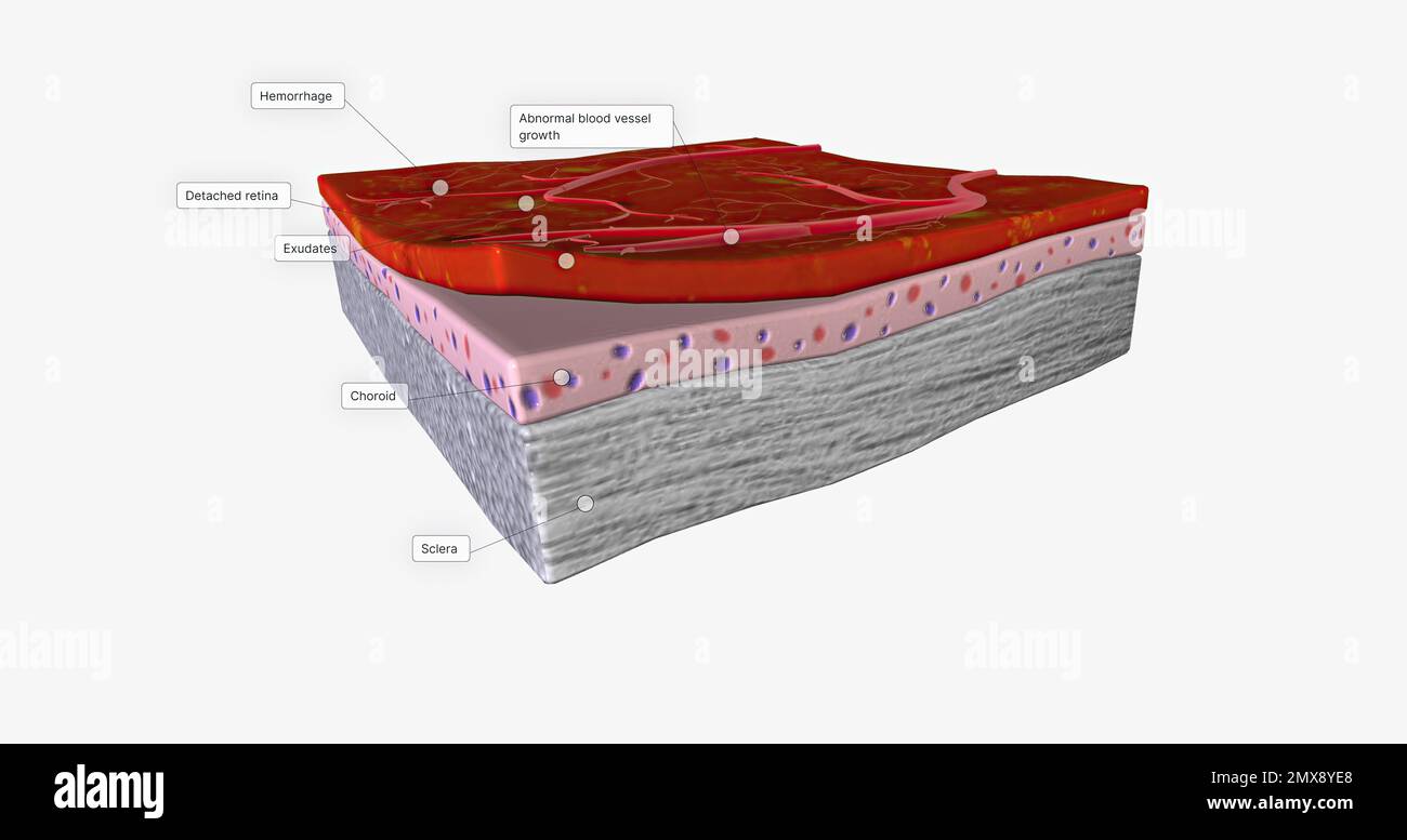 Human nerve tissue microscopy hi-res stock photography and images - Alamy