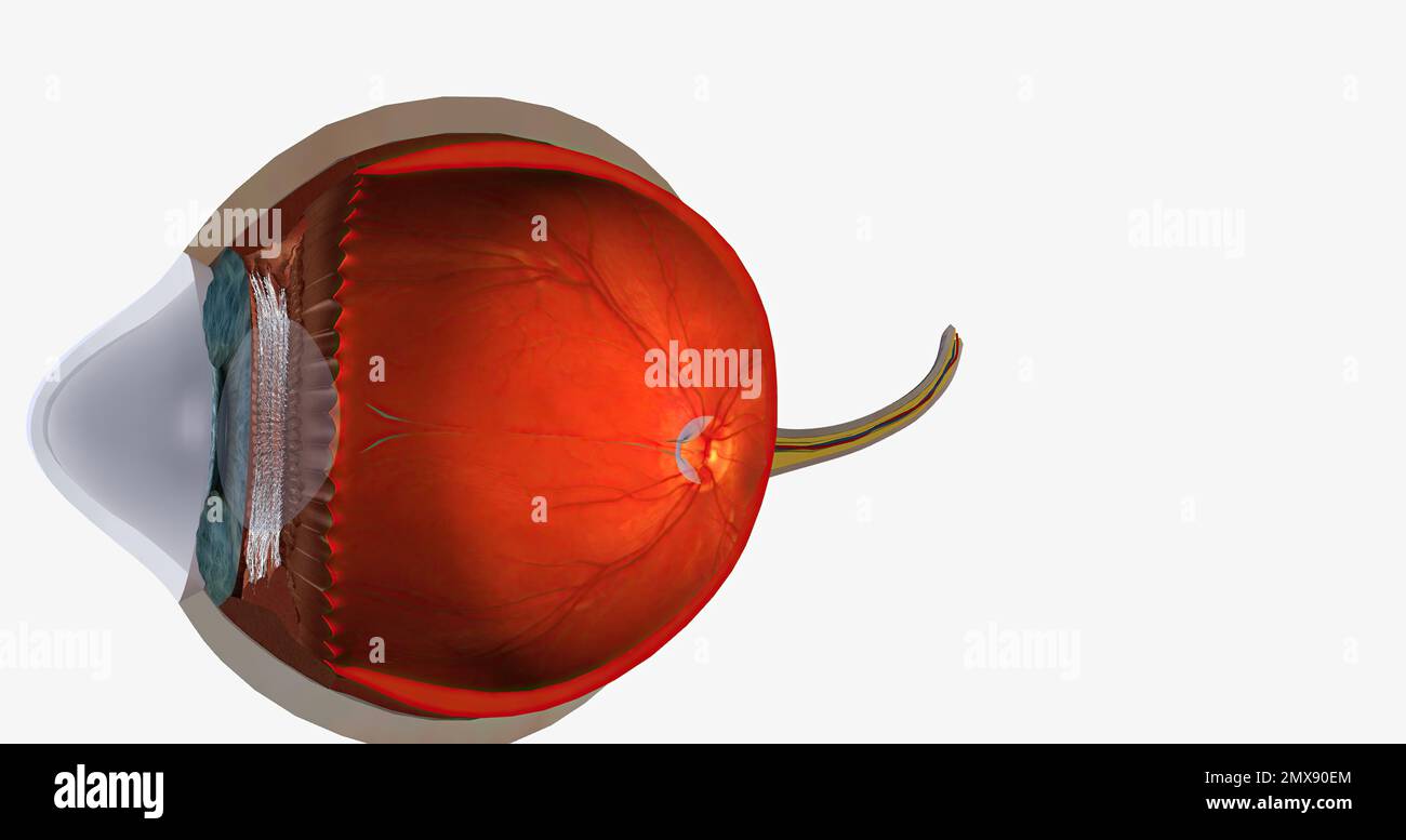 Keratoconus is an eye disease that affects the structure of the cornea