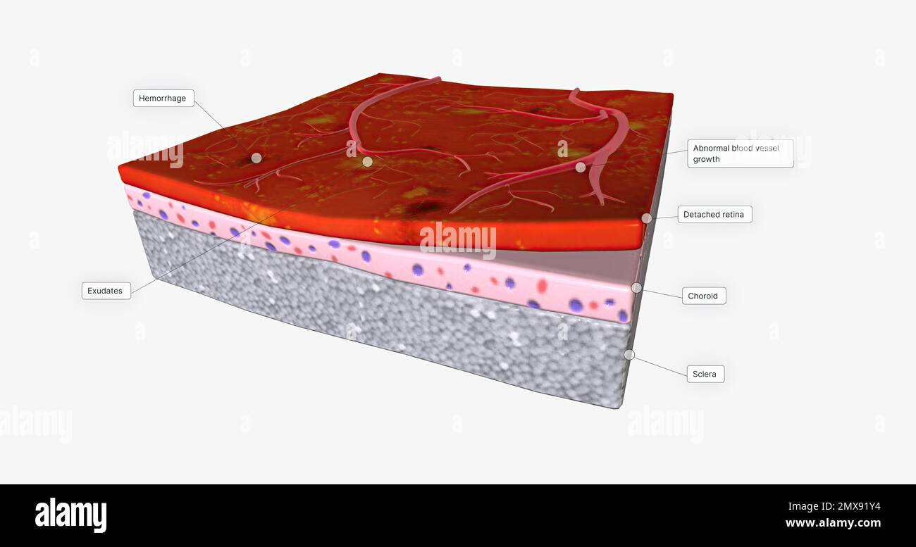 Human nerve tissue microscopy hi-res stock photography and images - Alamy