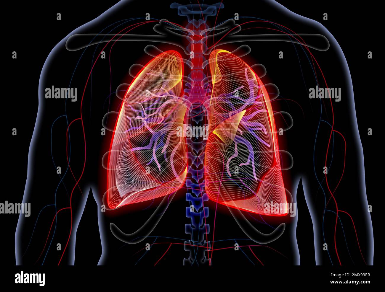 lung cancer archives