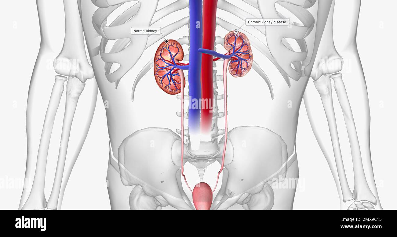 The kidneys filter waste out of the blood for the entire body. 3D