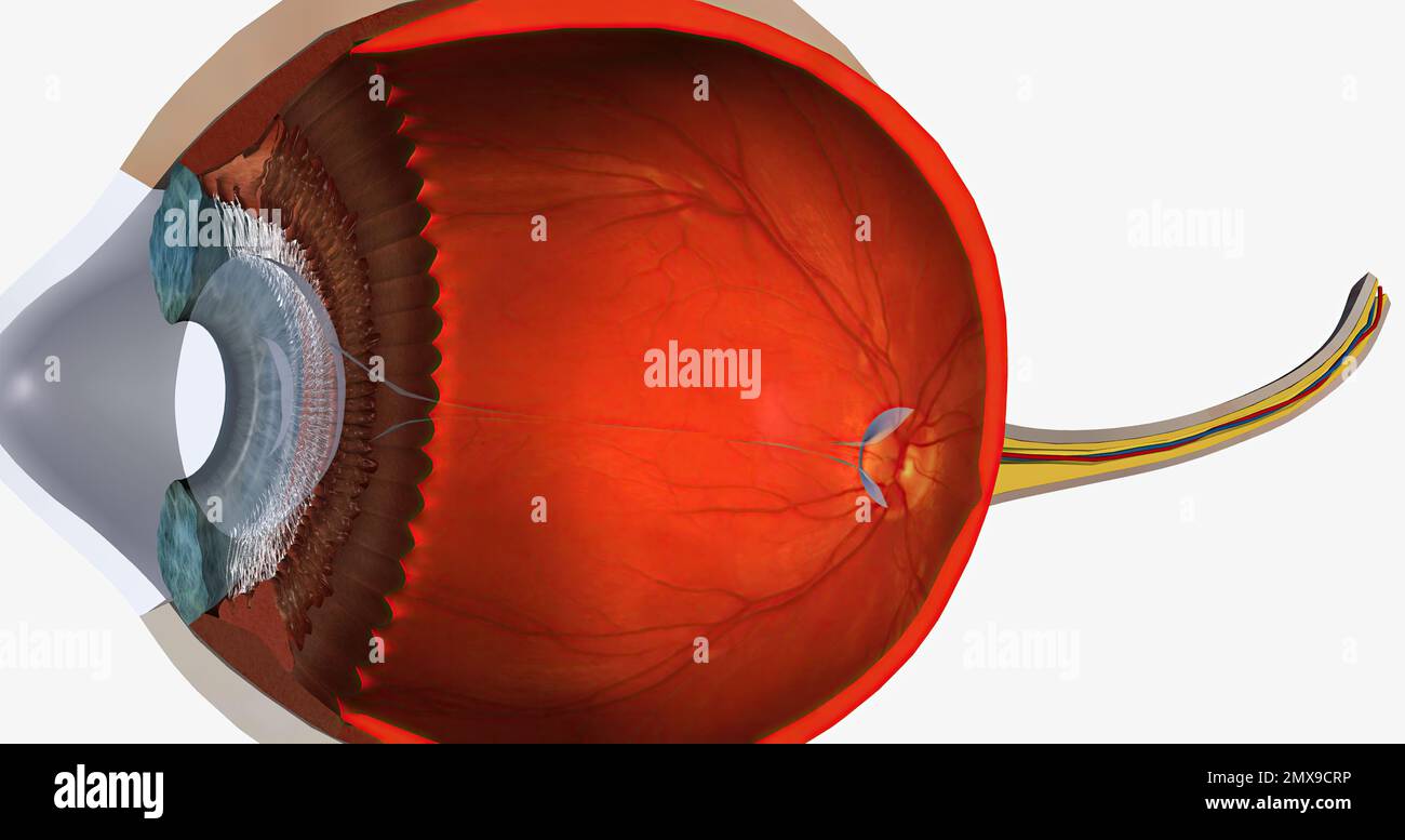 Keratoconus is an eye disease that affects the structure of the cornea