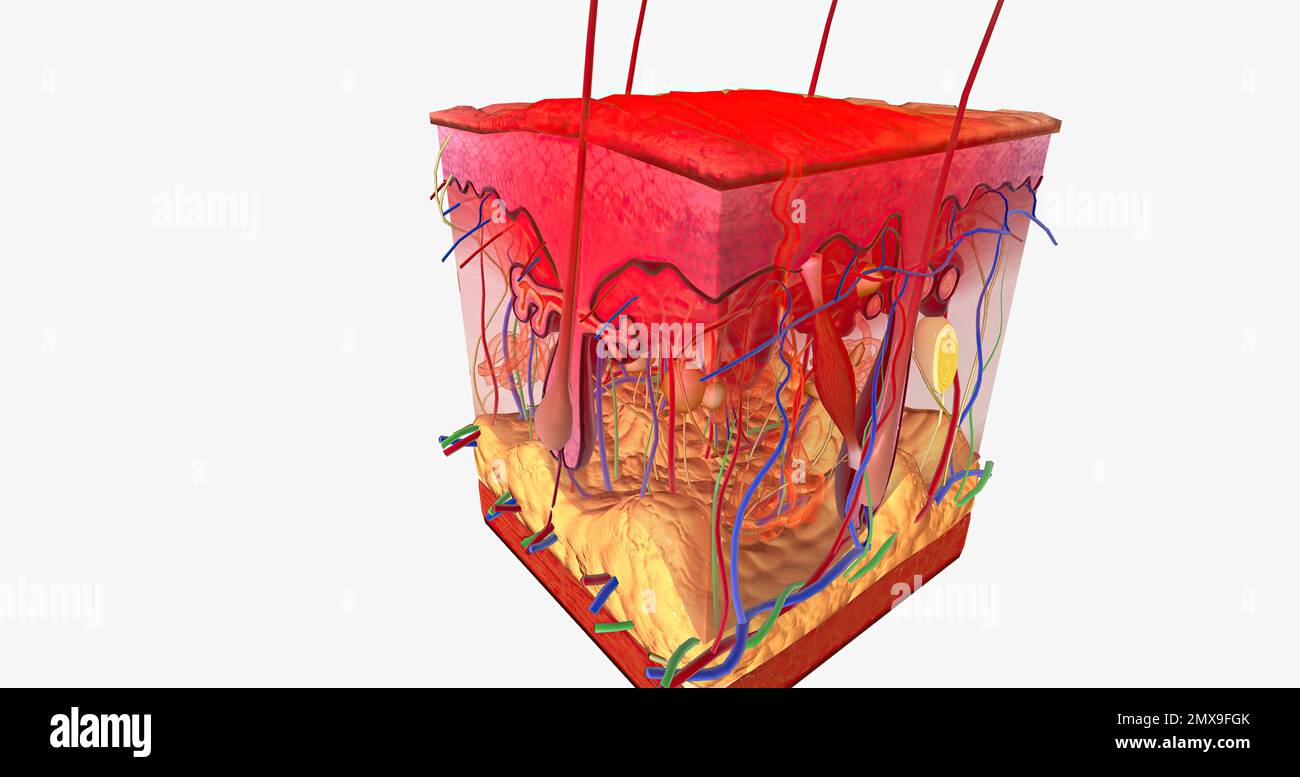 Contact Dermatitis in Skin Tissue 3D rendering Stock Photo Alamy