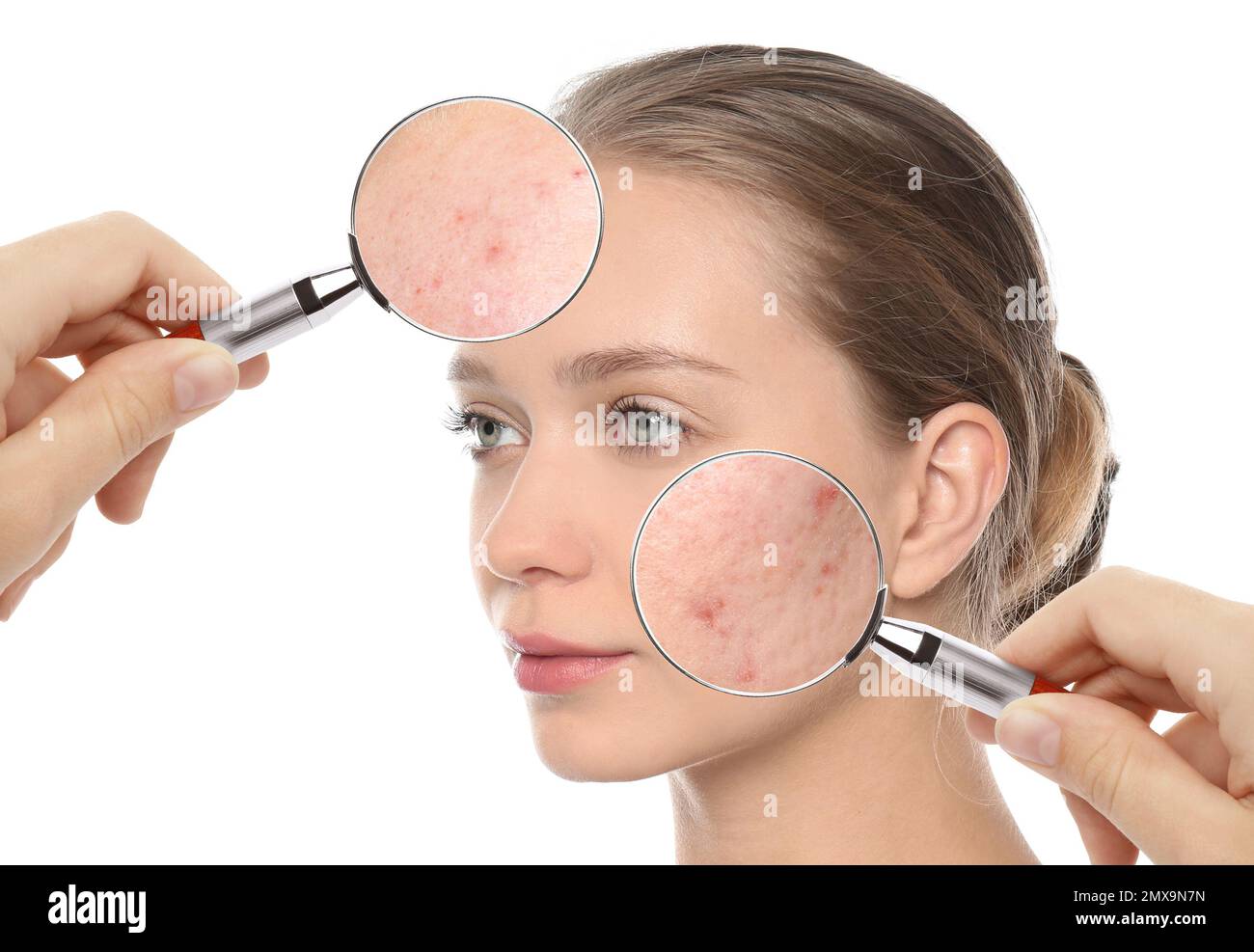 Woman magnifying glass skin hires stock photography and images Alamy