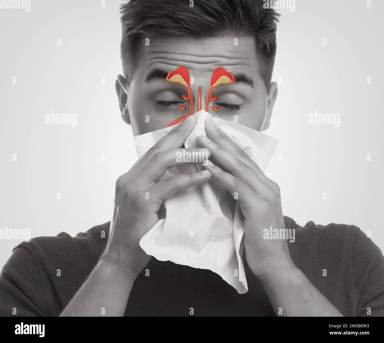 Man suffering from runny nose as allergy symptom. Sinuses illustration