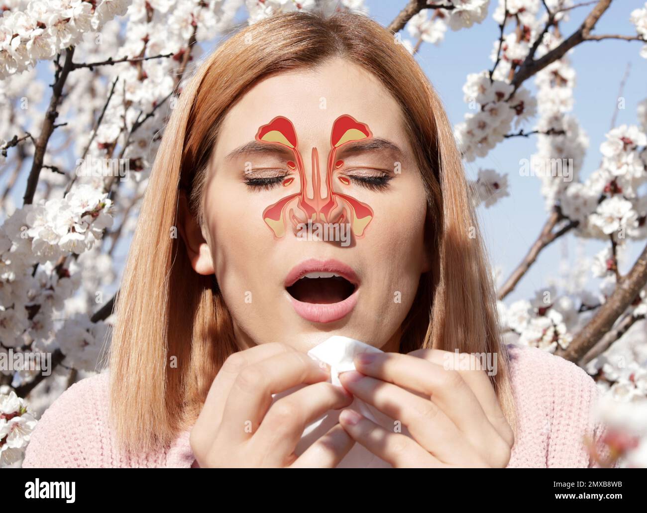 Woman sneezing and suffering from runny nose as allergy symptom