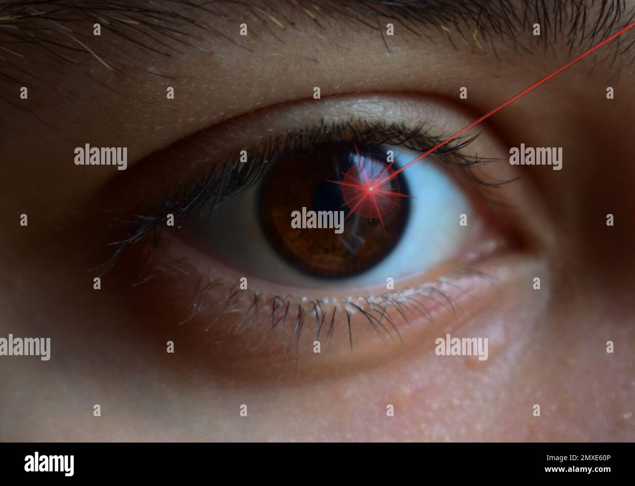 close up surgery of a female eye with a laser beam Stock Photo Alamy