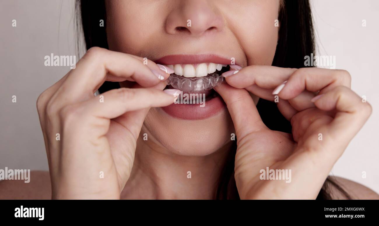 Clear Dental Aligner And Orthodontic Night Guard Stock Photo Alamy