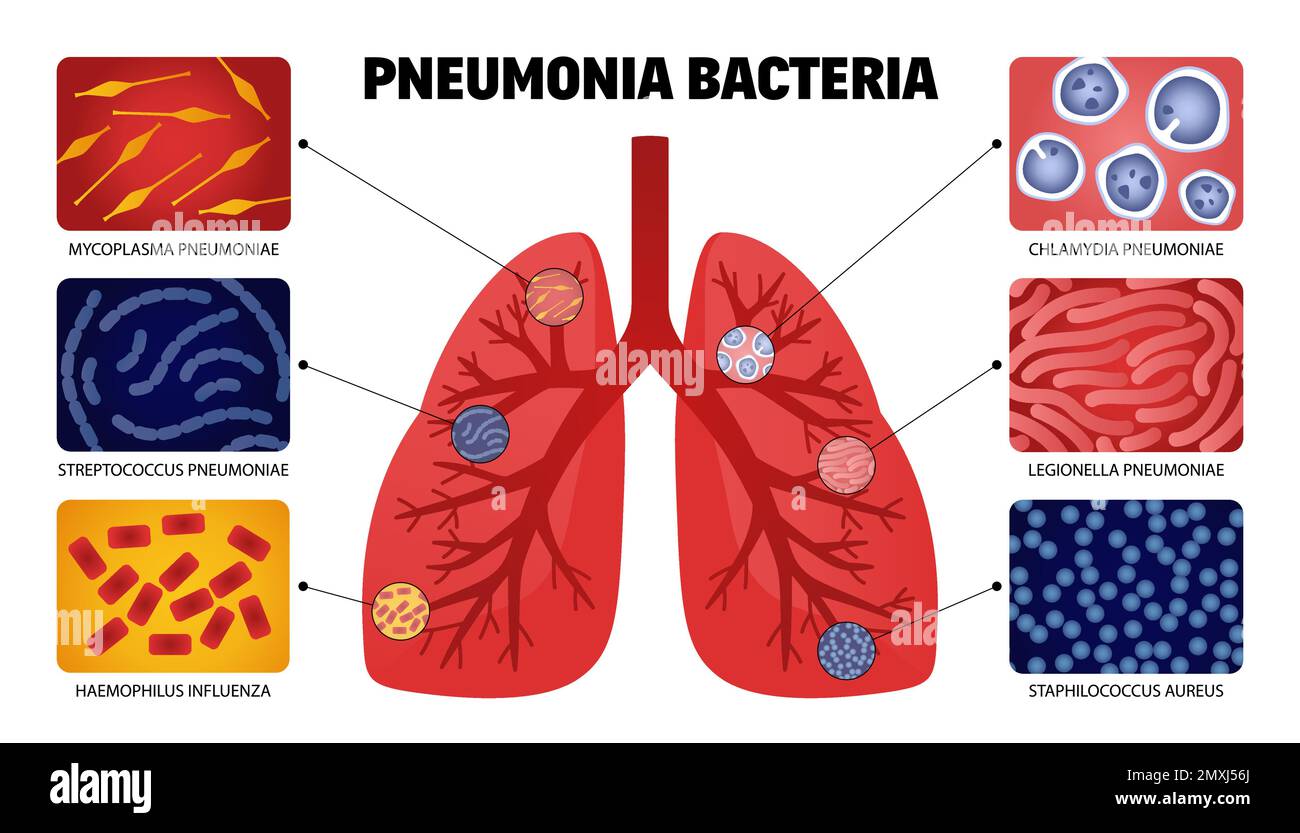 Human pneumonia bacteria set with isolated images of lungs anatomical shape with samples of