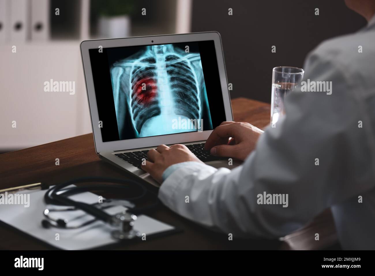 Doctor examining xray of patient with lung cancer on laptop in clinic