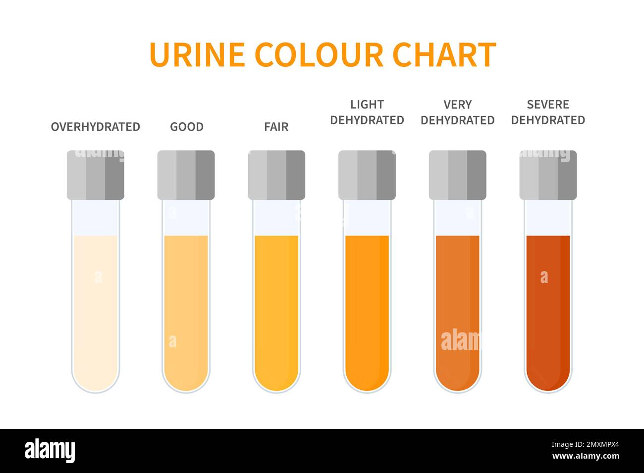 Urine colour chart, illustration Stock Photo - Alamy