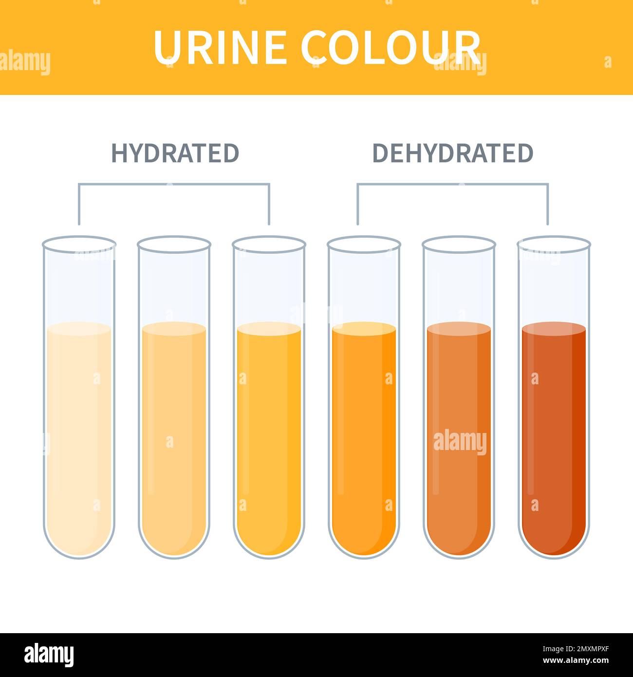 Urine Colour Chart Illustration Stock Photo Alamy