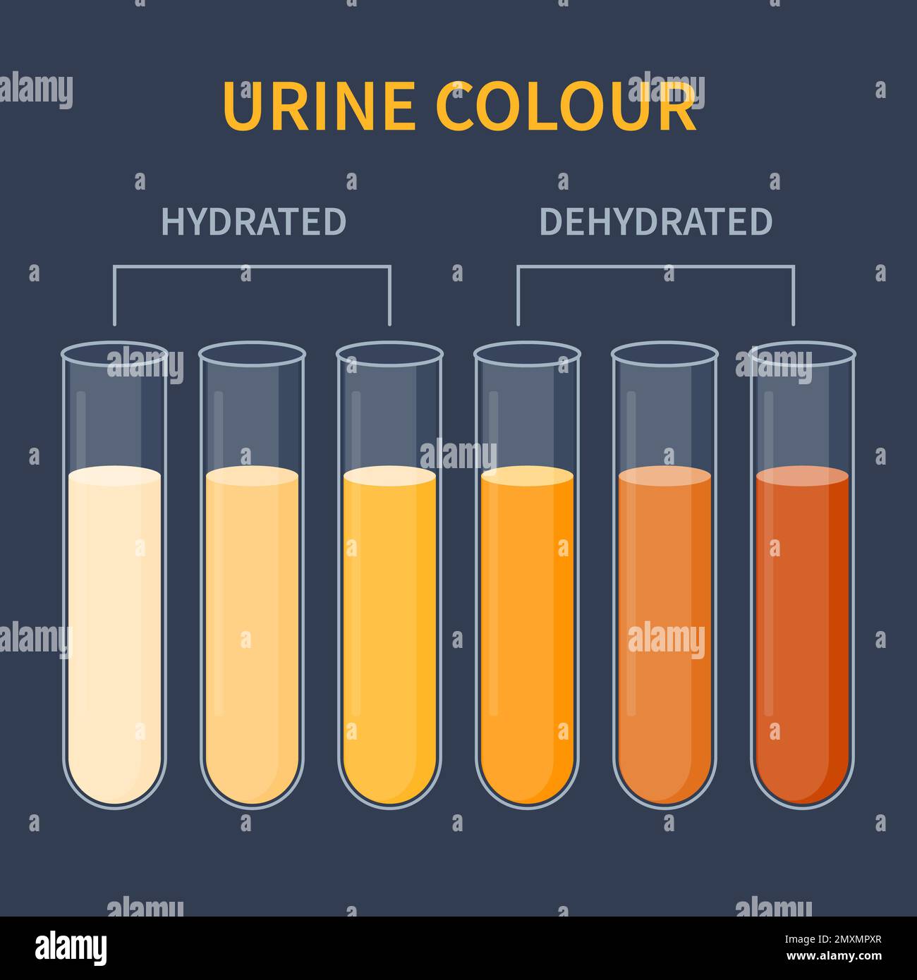 Urine colour chart, illustration Stock Photo Alamy