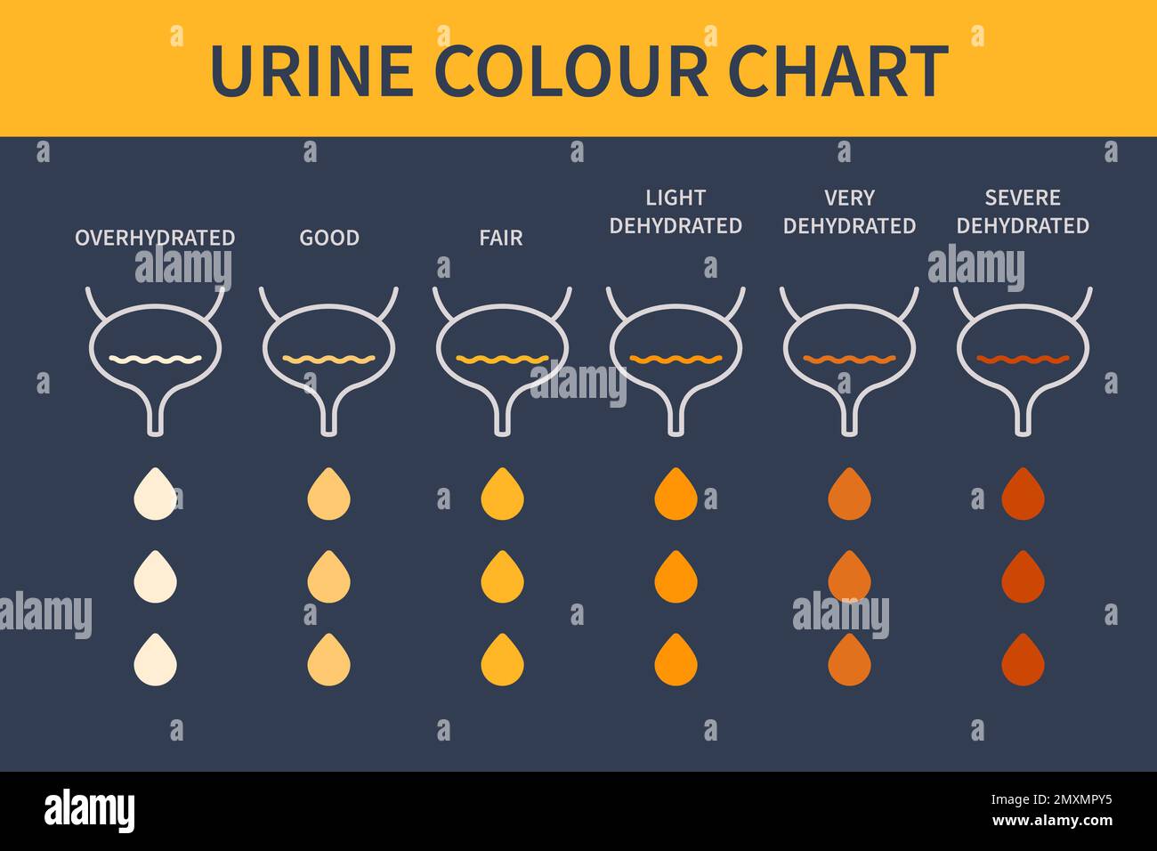 Urine colour chart illustration stock photo alamy