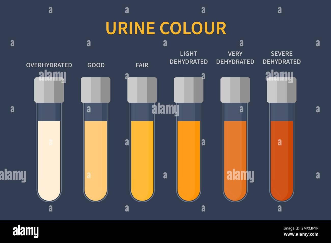 Urine colour chart, illustration Stock Photo Alamy