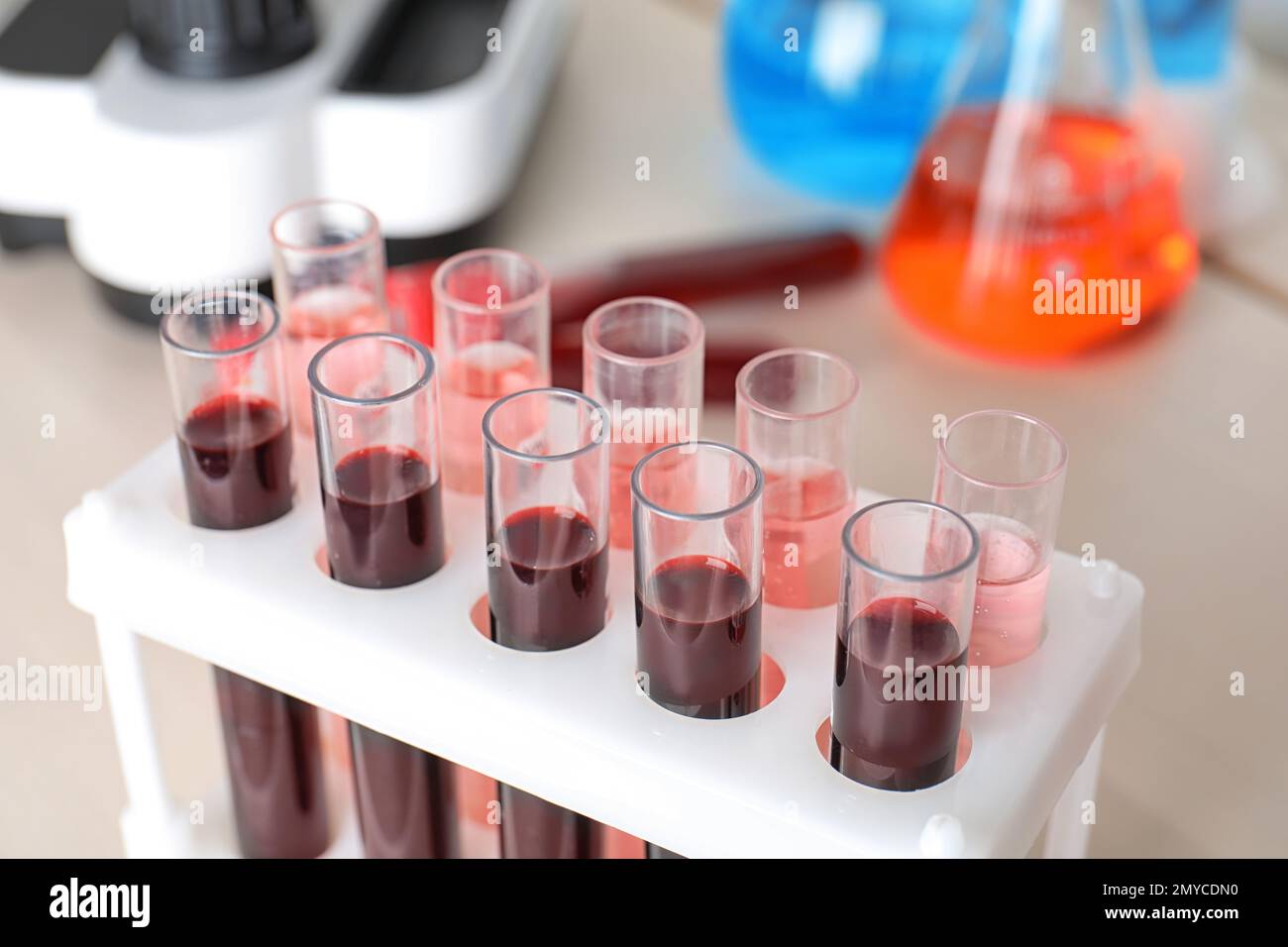 Test tubes with blood samples in rack on table, closeup. Laboratory ...