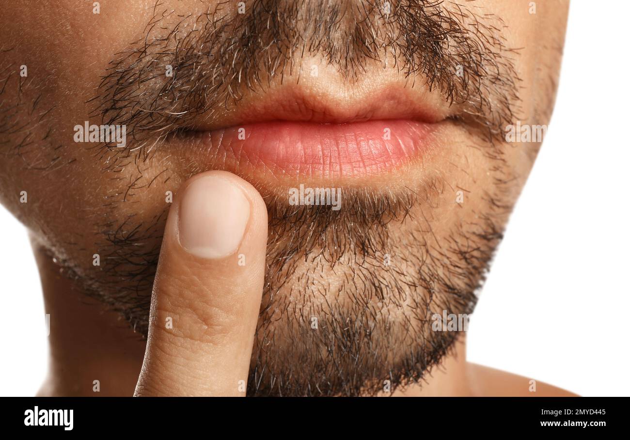 Young man with cold sore touching lips against white background