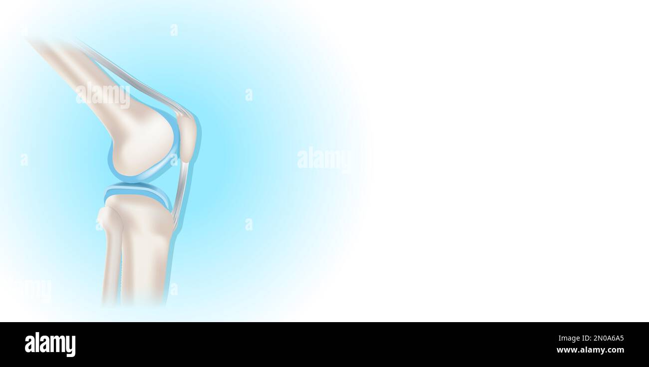 Vector Kneed Knee joint with healthy cartilage on blue and white background with ...