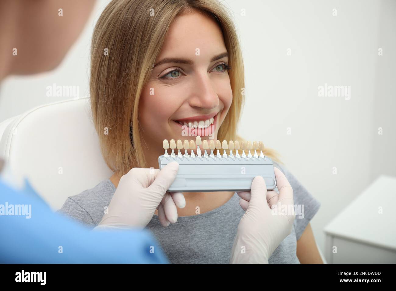 Doctor matching patient's teeth color with palette in clinic, closeup