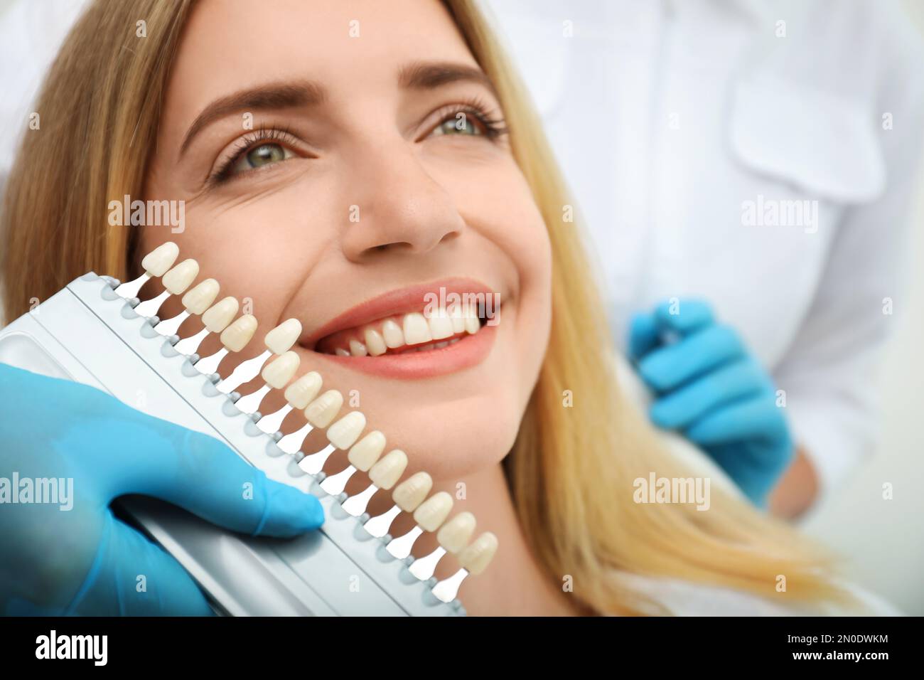 Doctor matching patient's teeth color with palette, closeup. Cosmetic