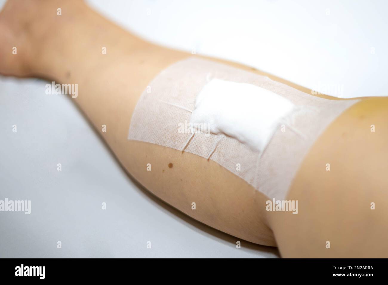 The old lady woman patient shows her scars after surgical wound surgery