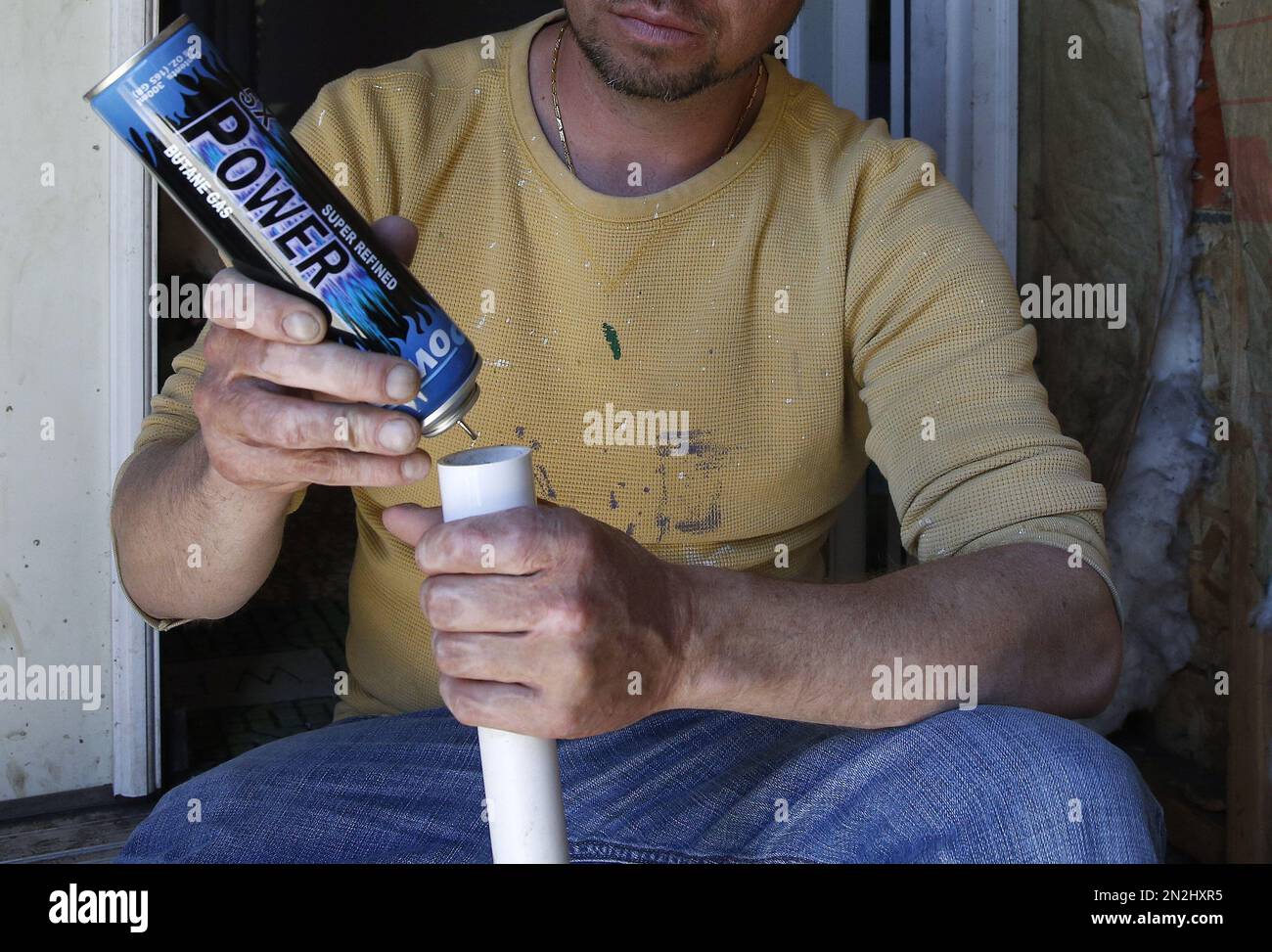 FILE In this May 1, 2014, file photo, a man who suffered severe burns