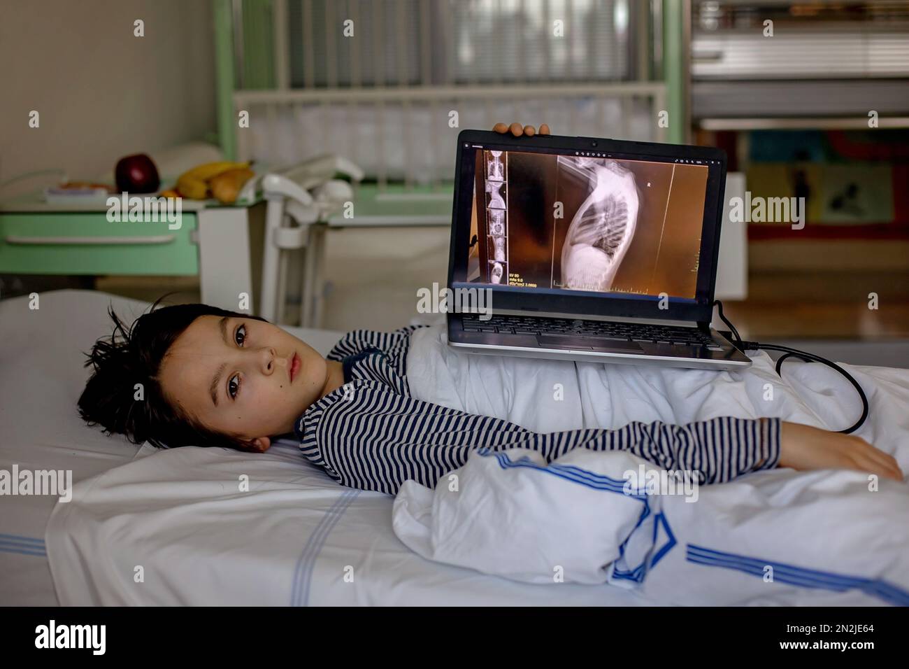 Preteen child, boy, lying in hospital with fractured thoracic spine
