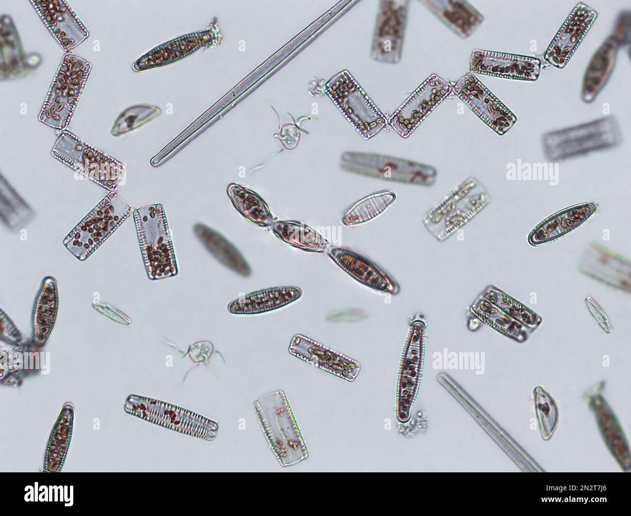 Diatoms, algae under microscopic view, phytoplankton, fossils, silica