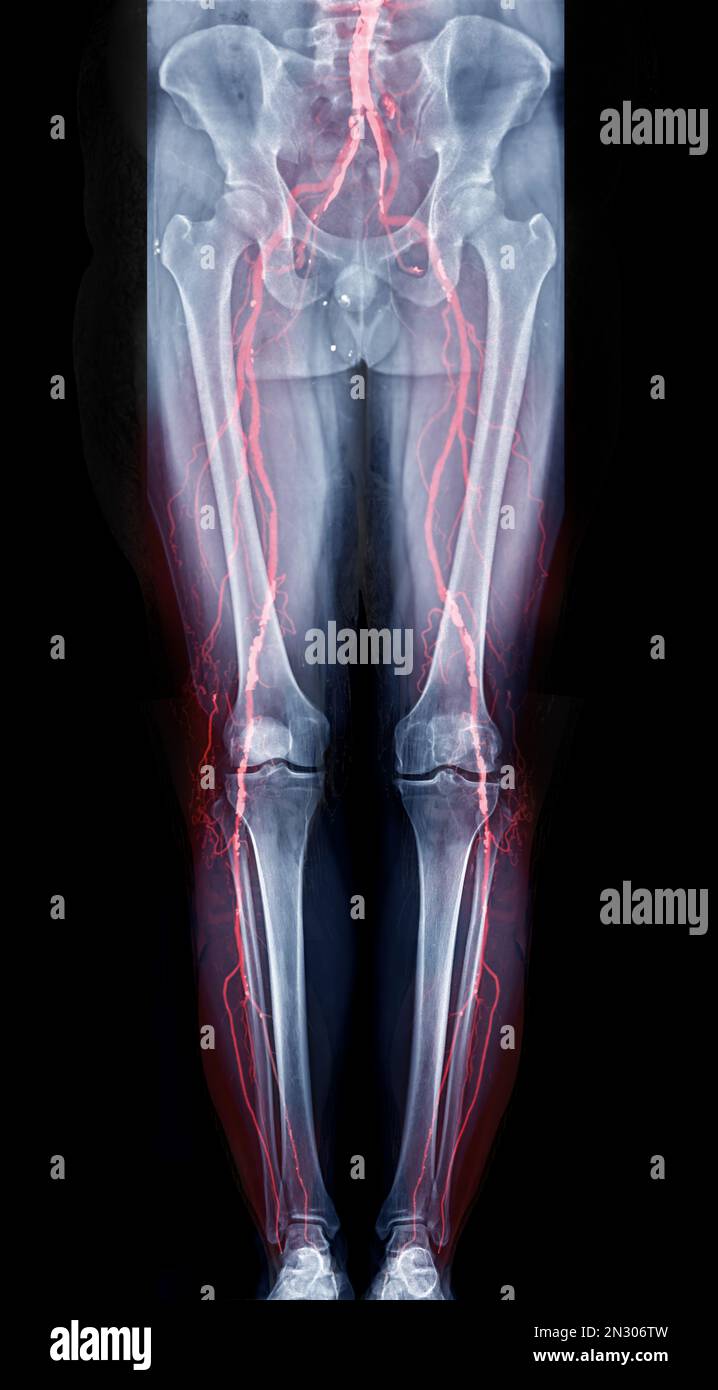 What Is A Scanogram X Ray at Louise Donald blog